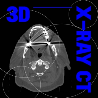 <b>X-ray影像-X-ray</b> 3D X-ray CT常見的影像干擾